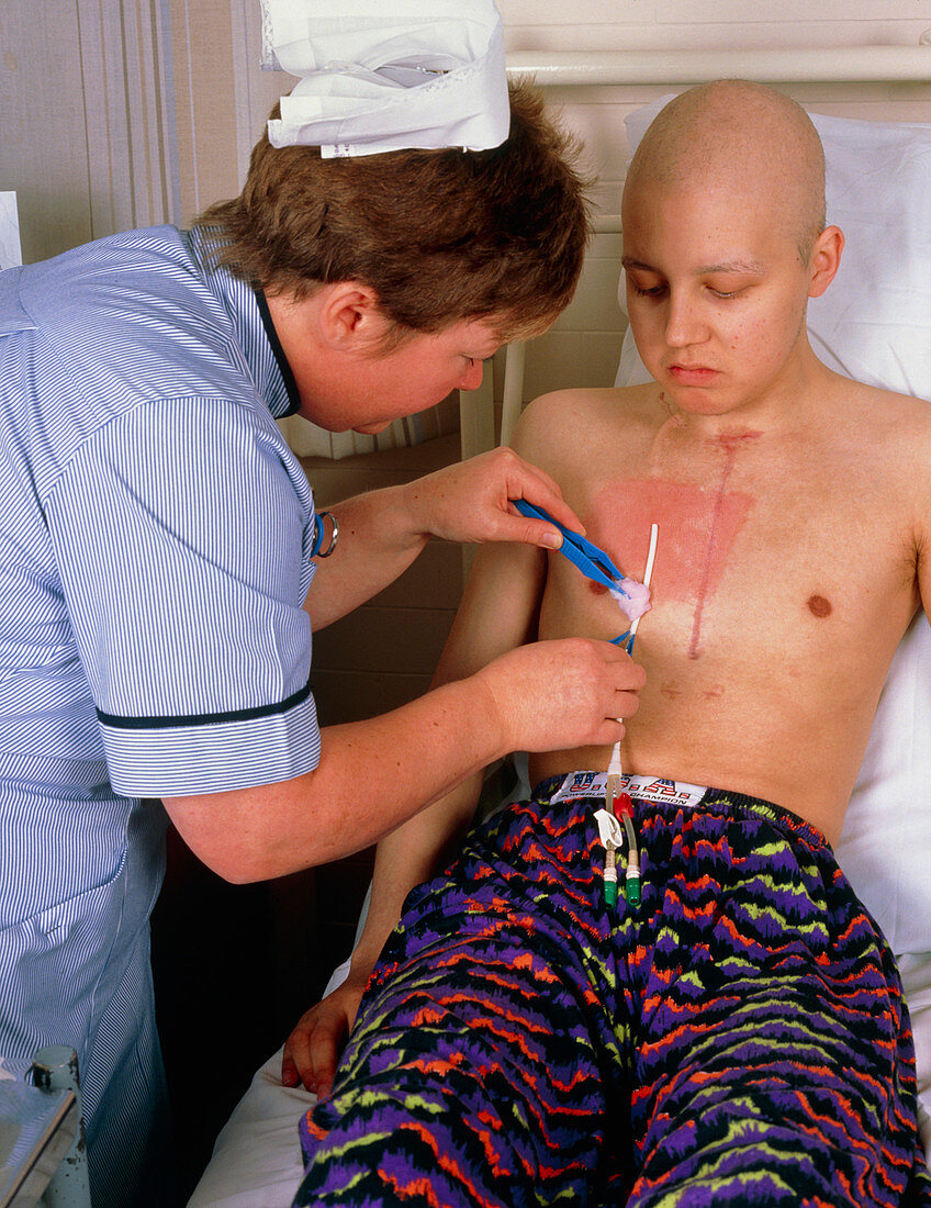Disinfecting chest catheter in male cancer patient