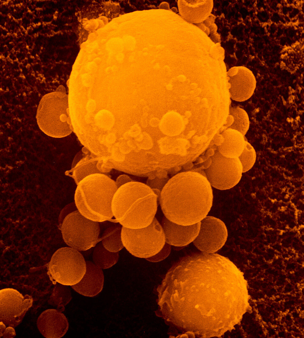 SEM of T-lymphocyte killer cell