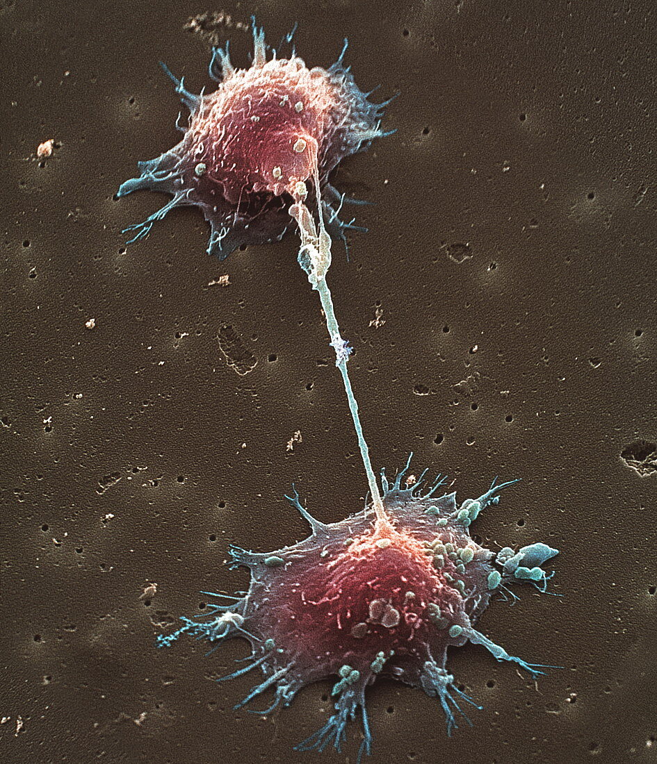SEM of prostate cancer cell division