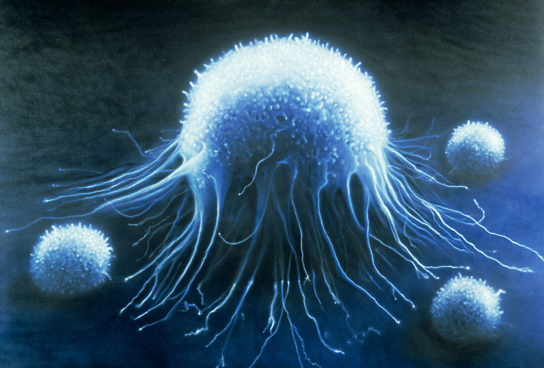 Artwork of SEM of cancer cell and 3 T-lymphocytes