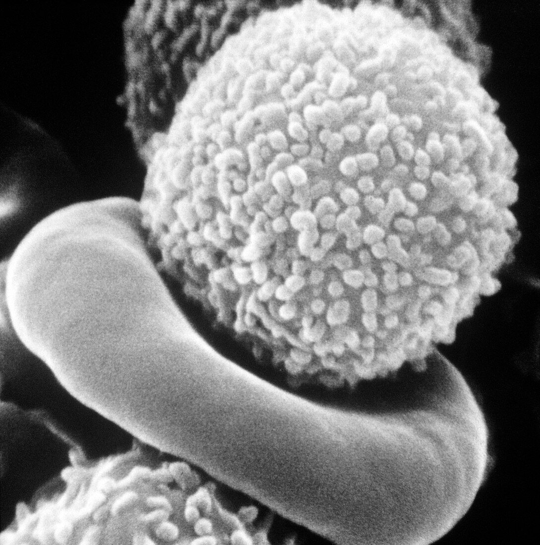 SEM of white blood cell from patient