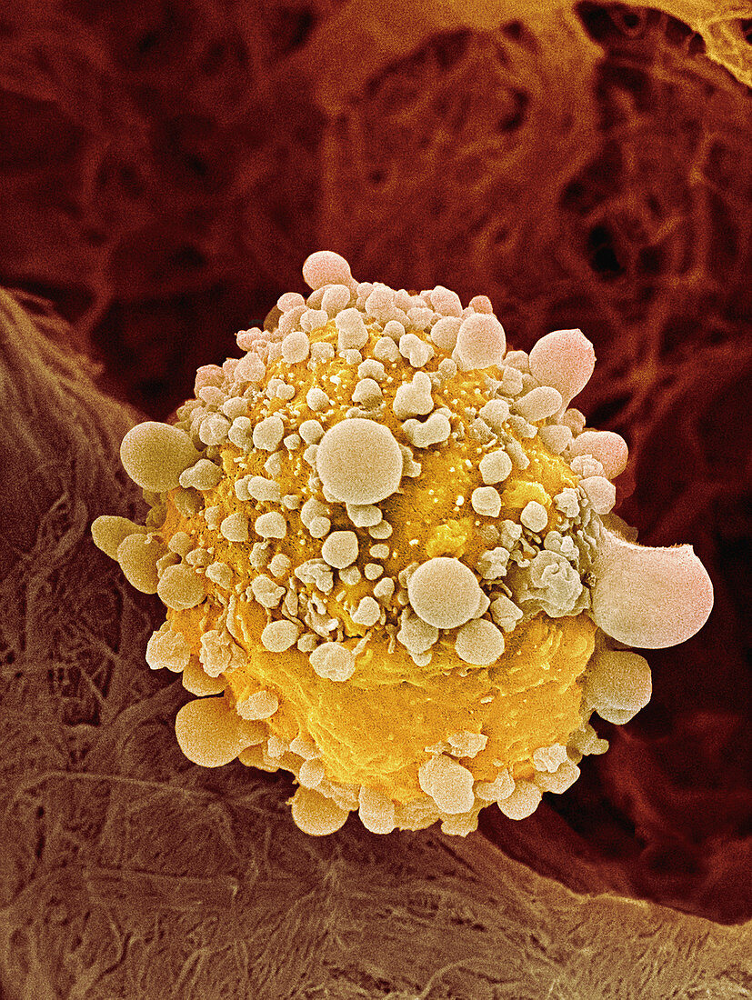 Pancreatic cancer cell,SEM