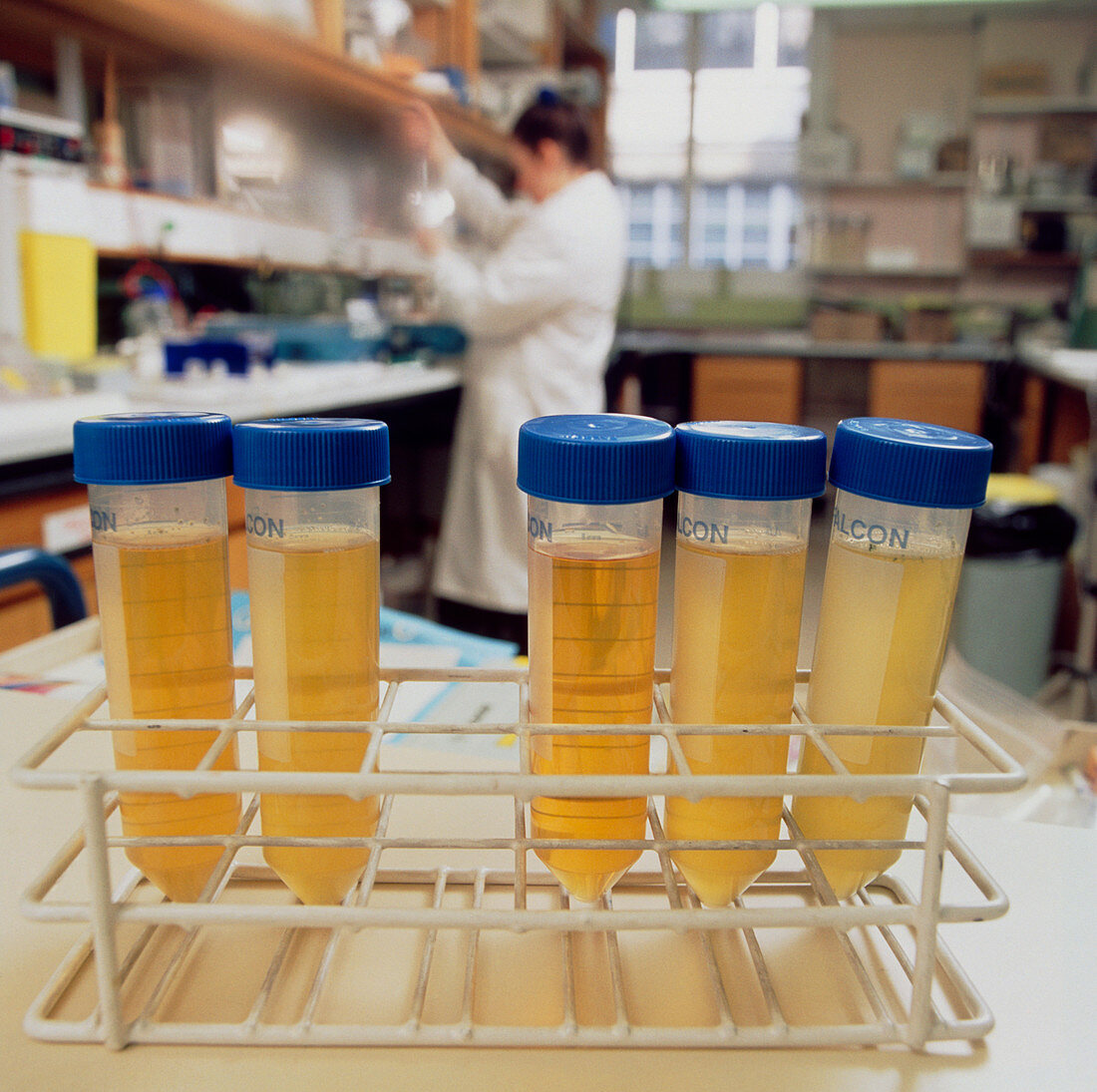 Faecal samples for bowel cancer DNA screening
