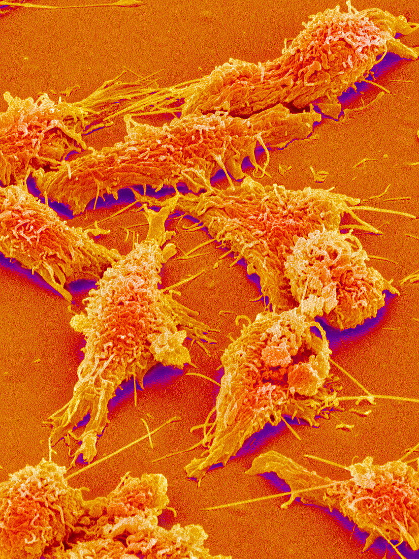 Colon cancer cells,SEM