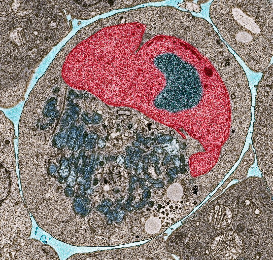 Myeloma cell,TEM