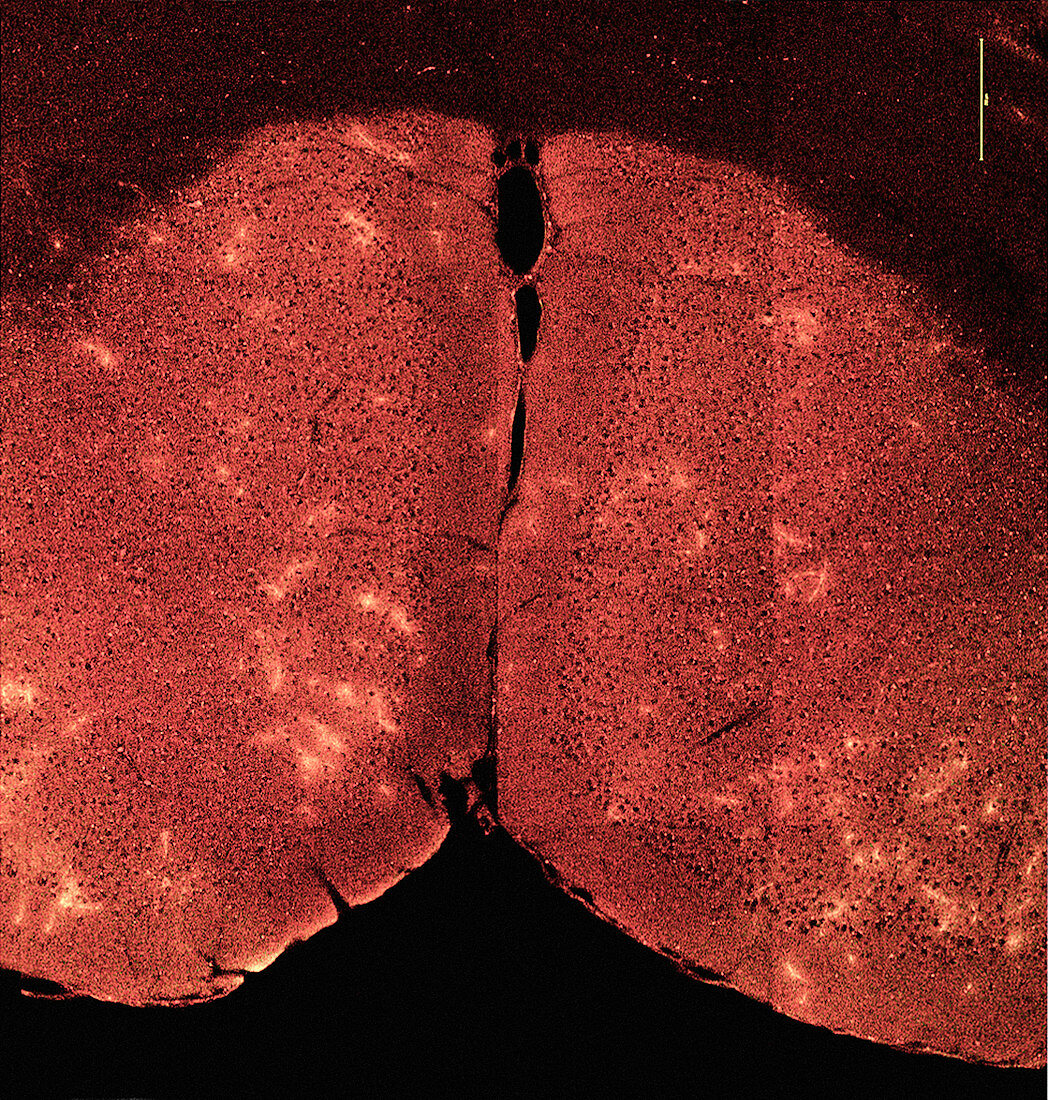 Blood-brain barrier breakdown