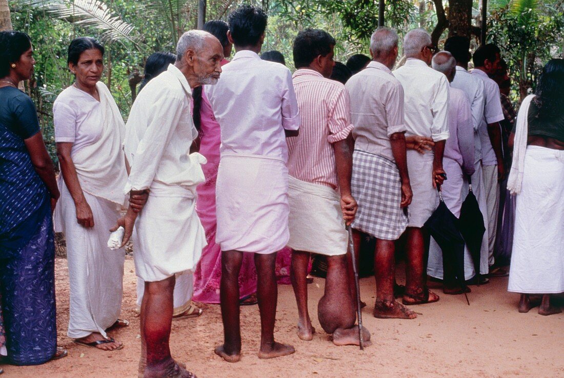 Patients queuing at filariasis clinic in India