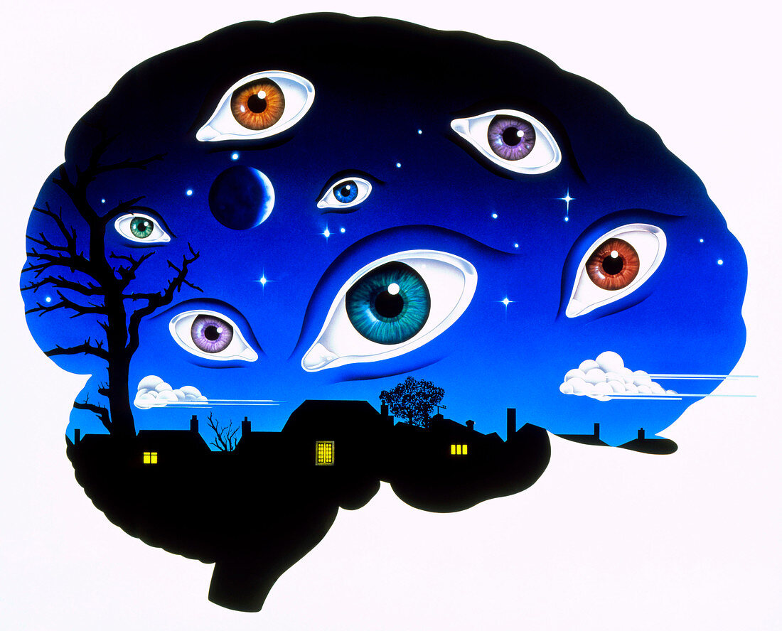 Artwork of brain depicting insomnia,or dreaming