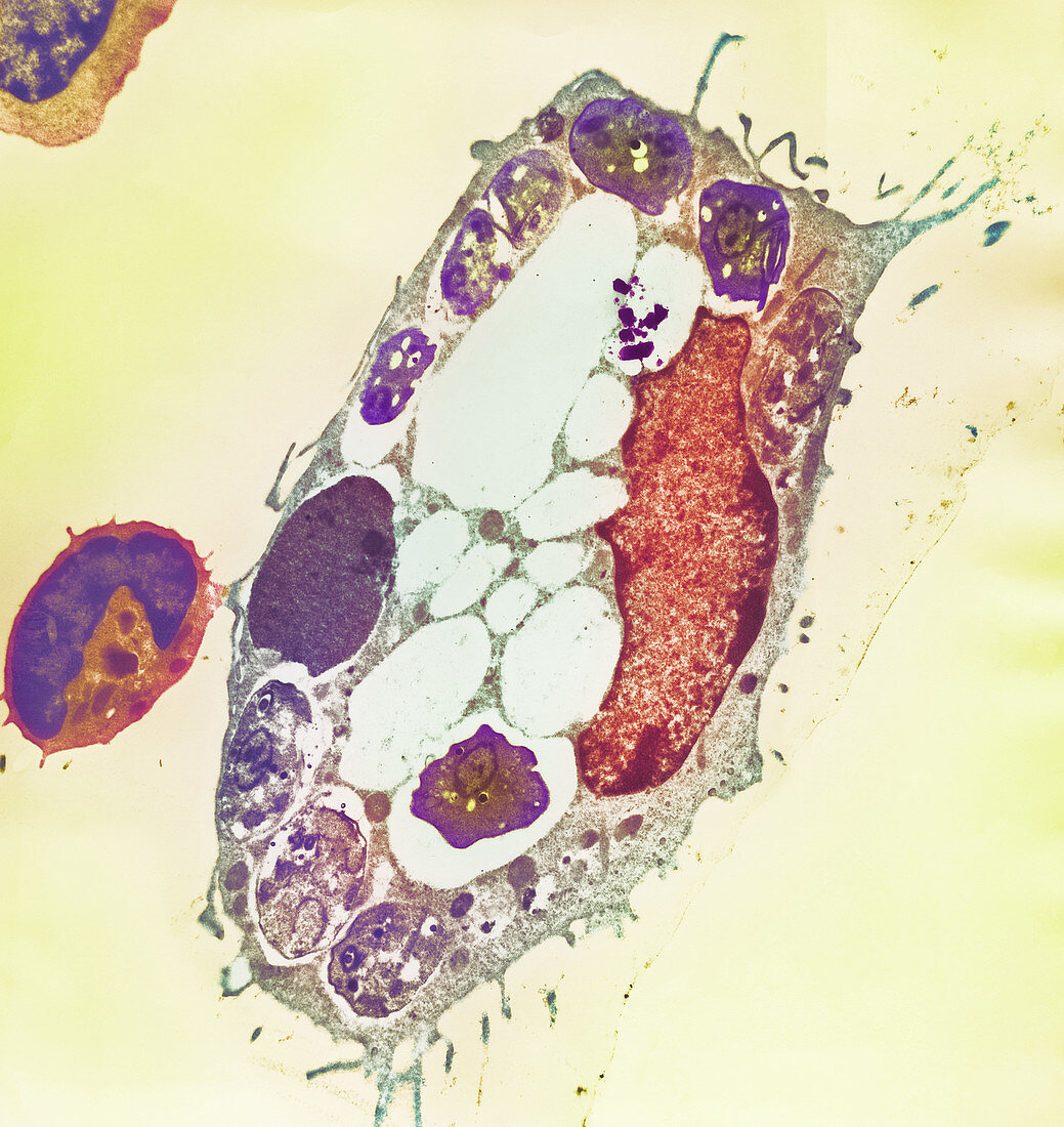 Leishmania protozoa,TEM