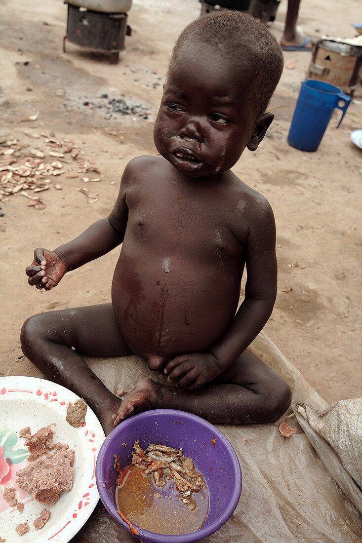 Malnourished child being fed