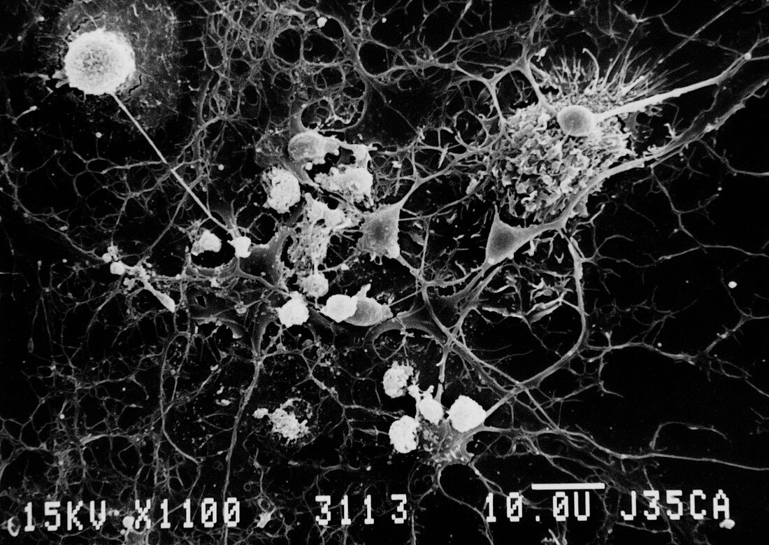 SEM of microglial cells ingesting oligodendrocytes