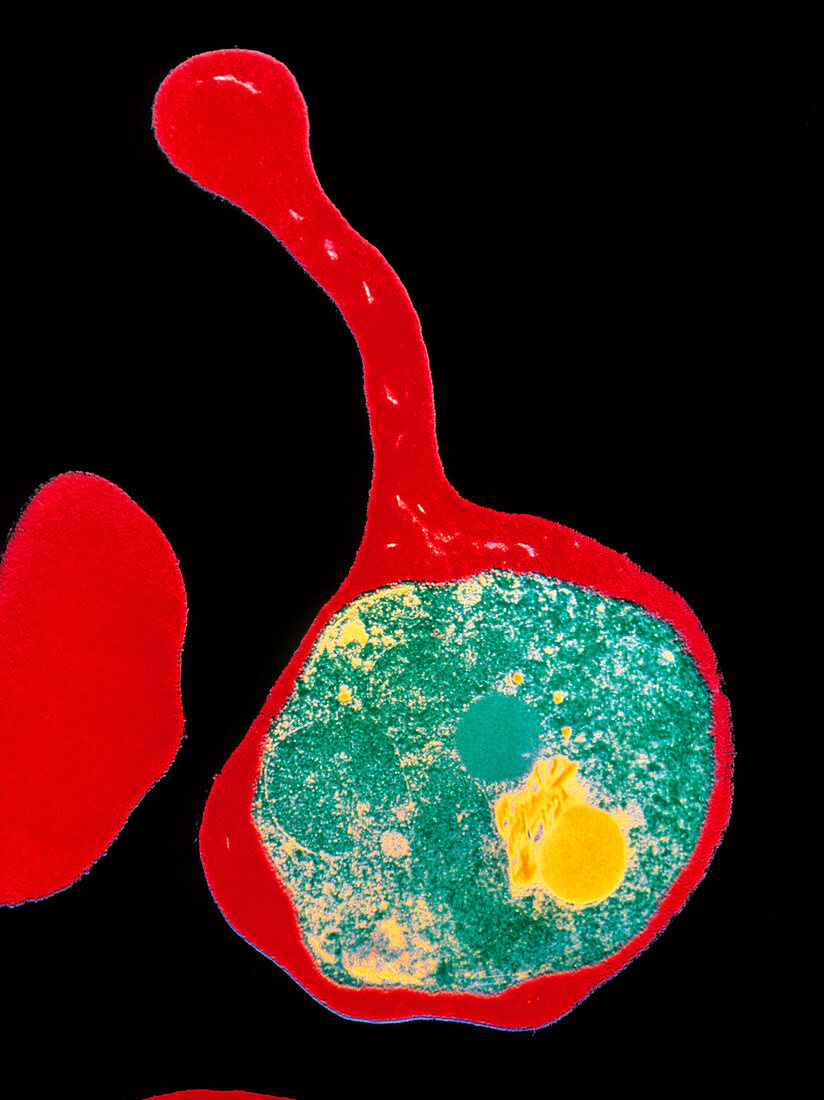Coloured TEM of a red blood cell with malaria