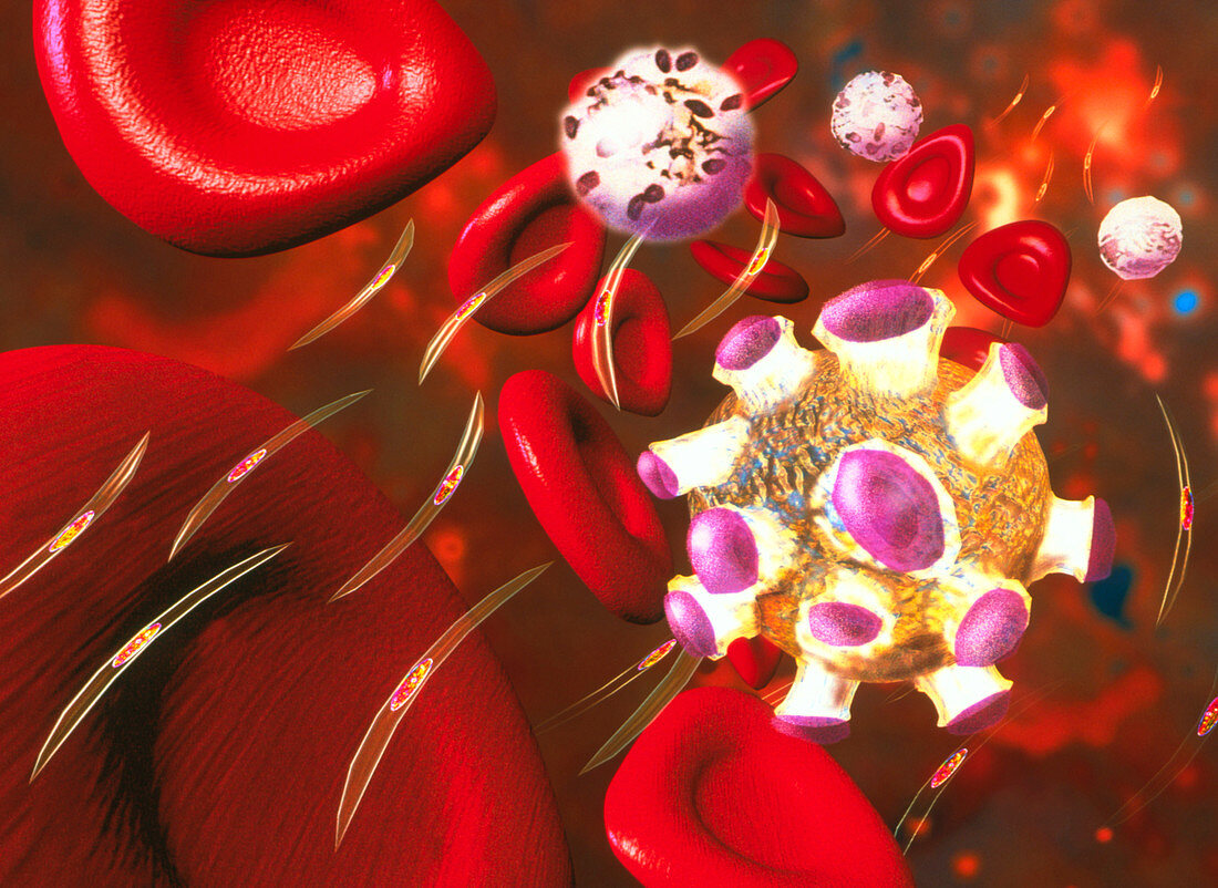 Artwork of infected red blood cells in malaria