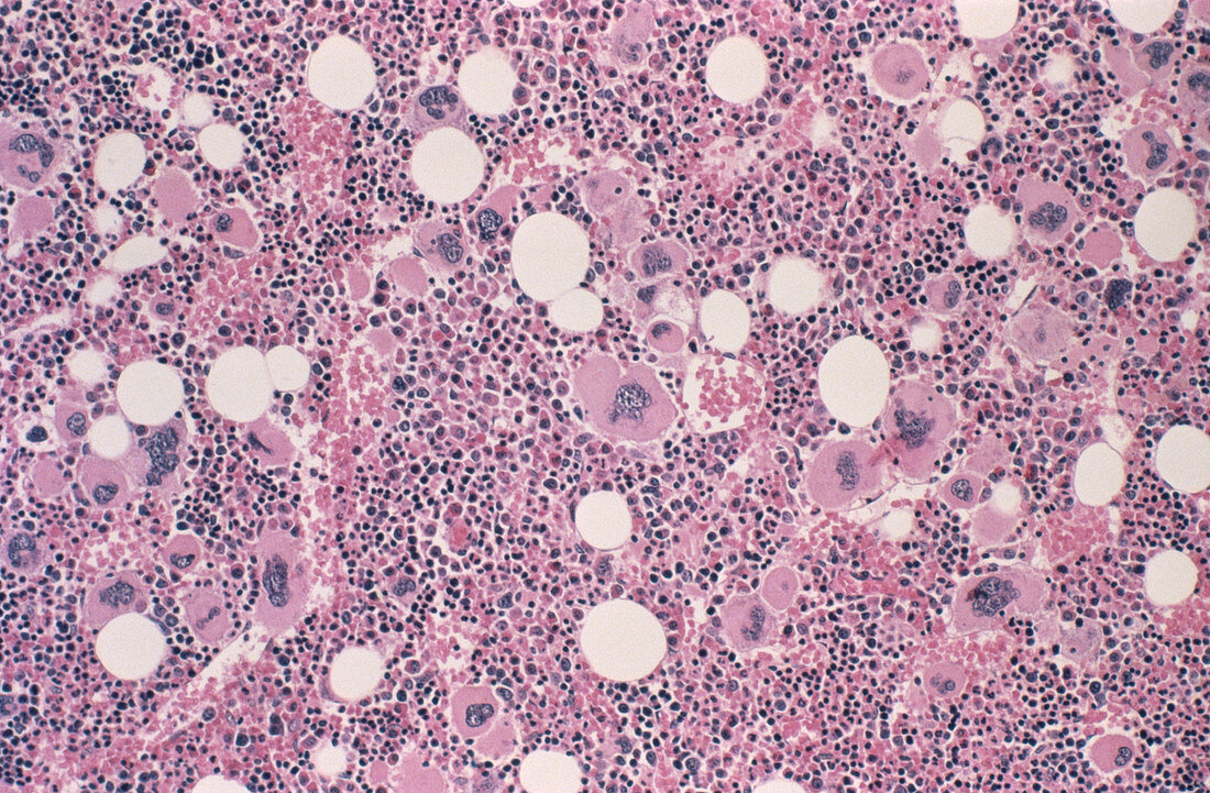 Enlarged spleen,light micrograph