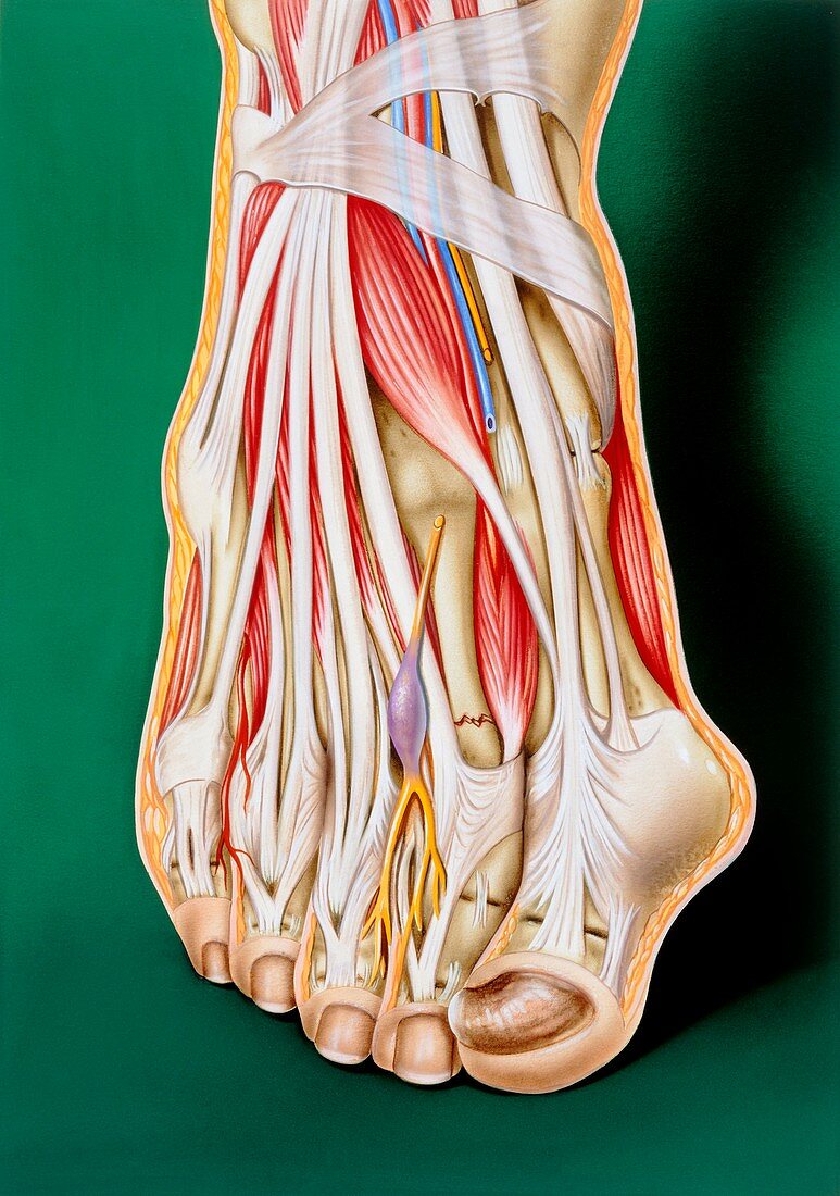 Art of a human foot showing various disorders