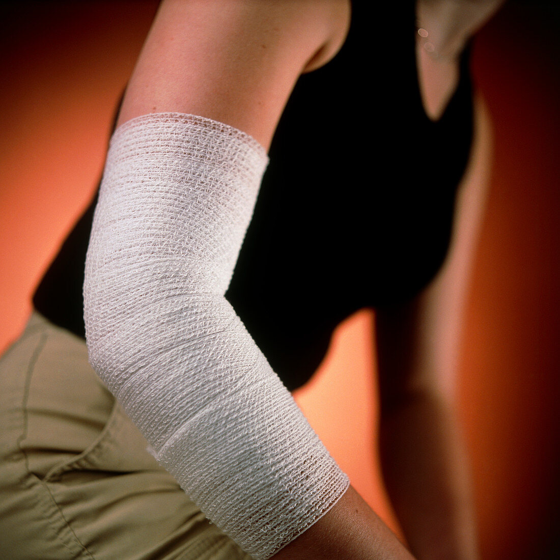 View of the bandaged elbow of a young woman