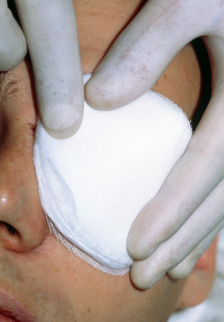 Gloved fingers apply dressing to patient's eye
