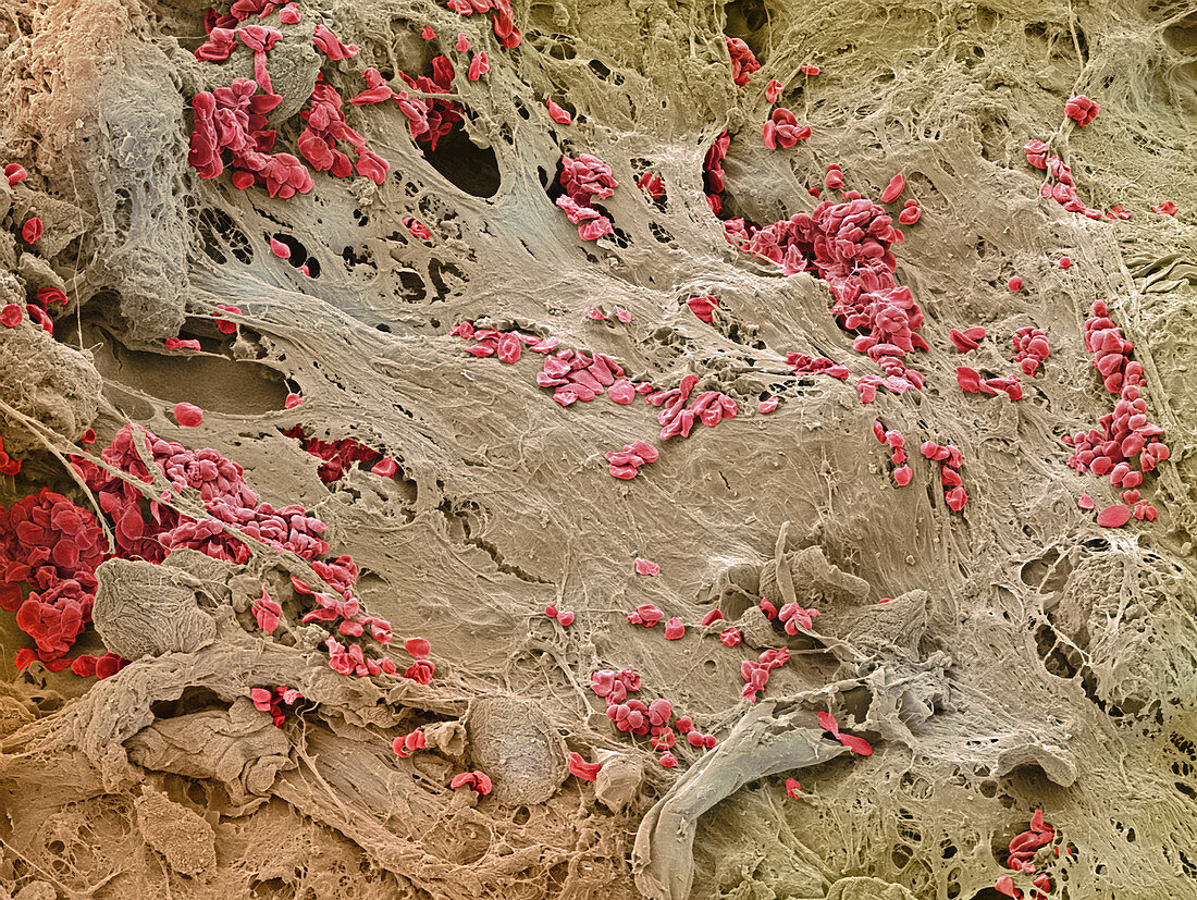 Healing wound,SEM