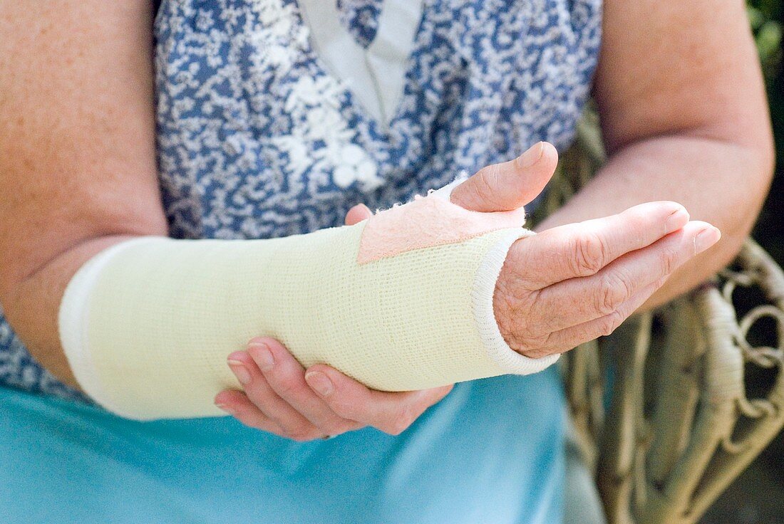 Senior lady with a broken arm