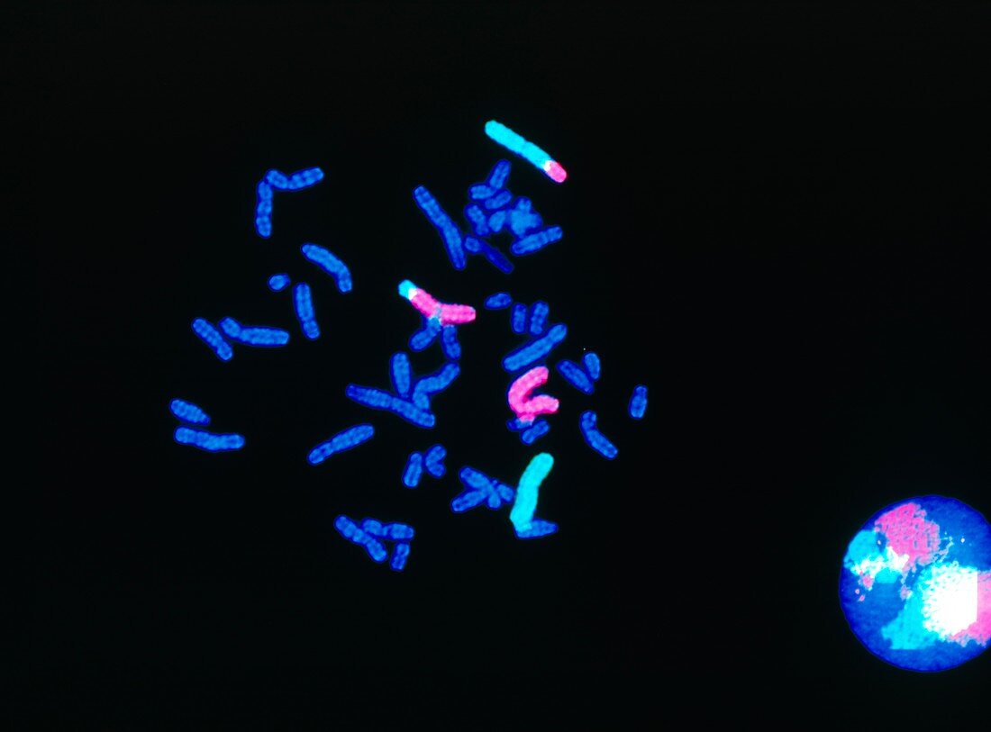 FISH micrograph of chromosome 2:3 translocation