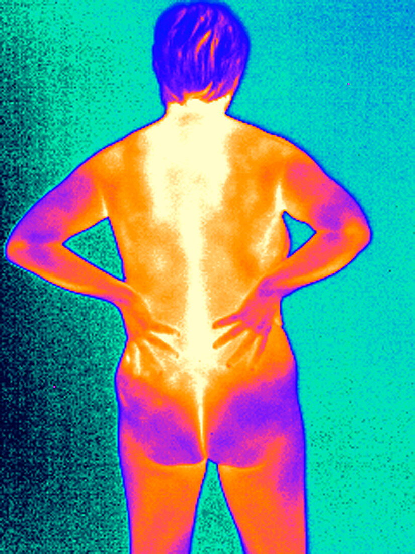Back pain,thermogram