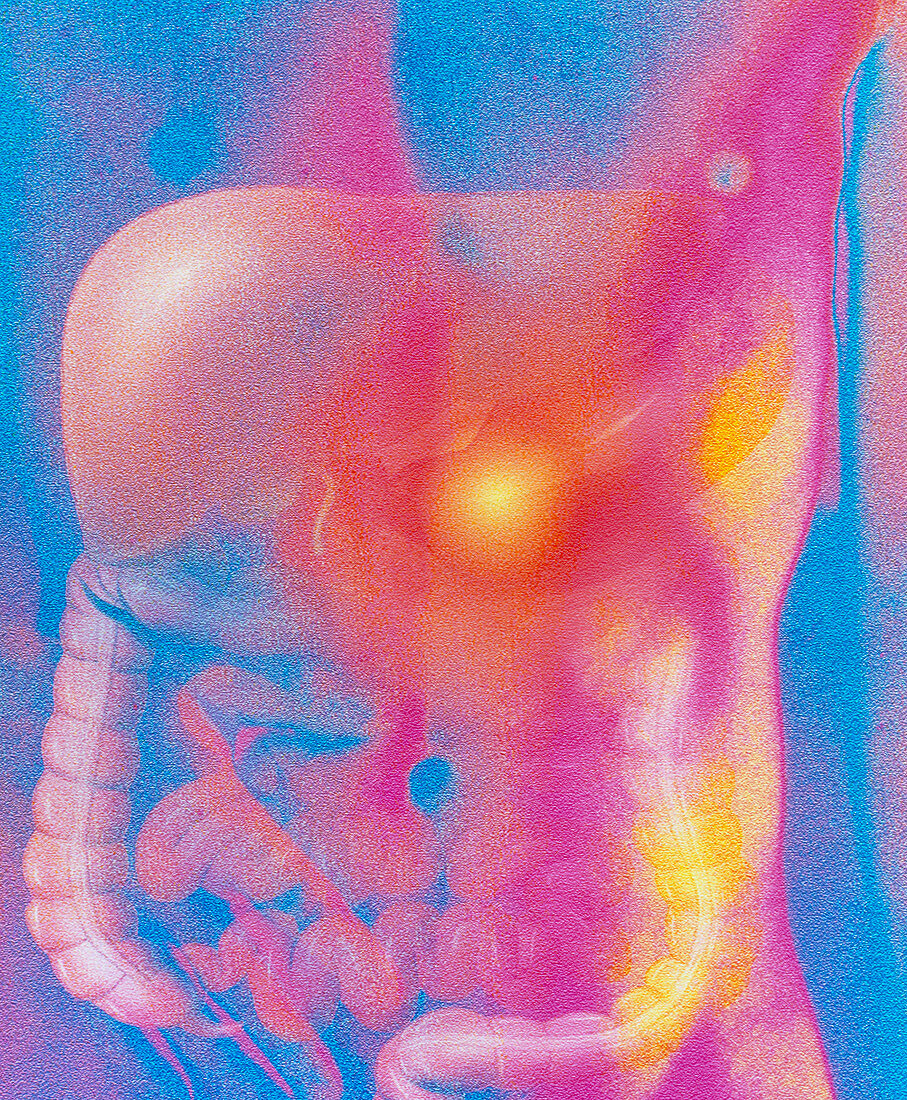 Computer art of male torso depicting stomach pain