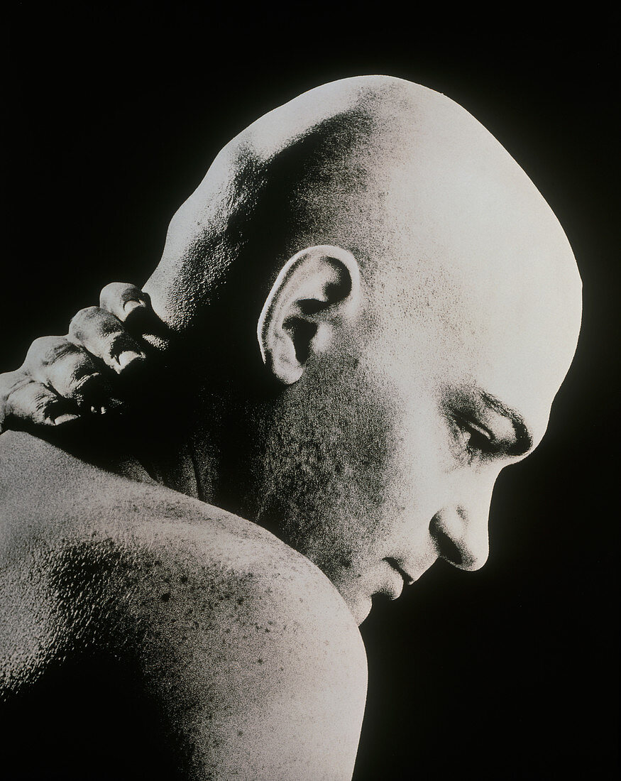 Bald man holding his neck suffering from pain