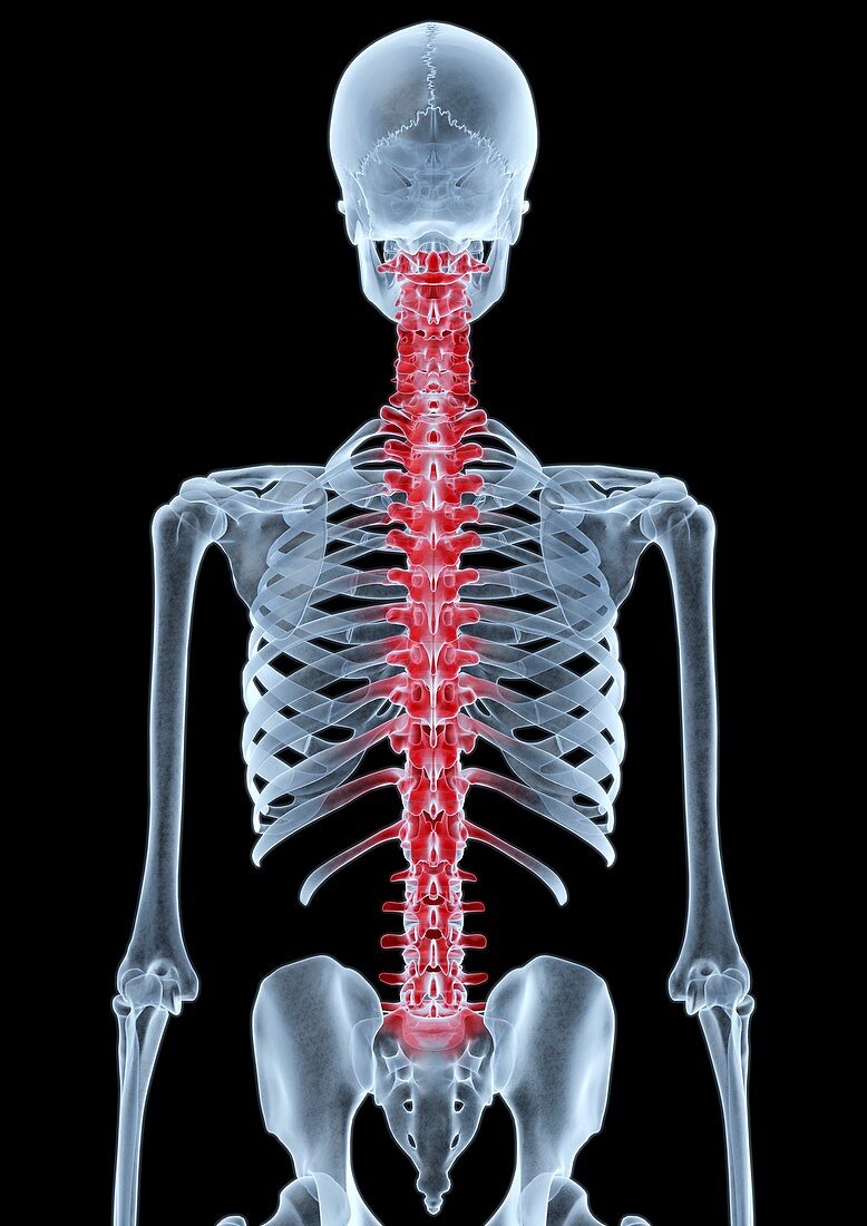 Back pain,X-ray artwork