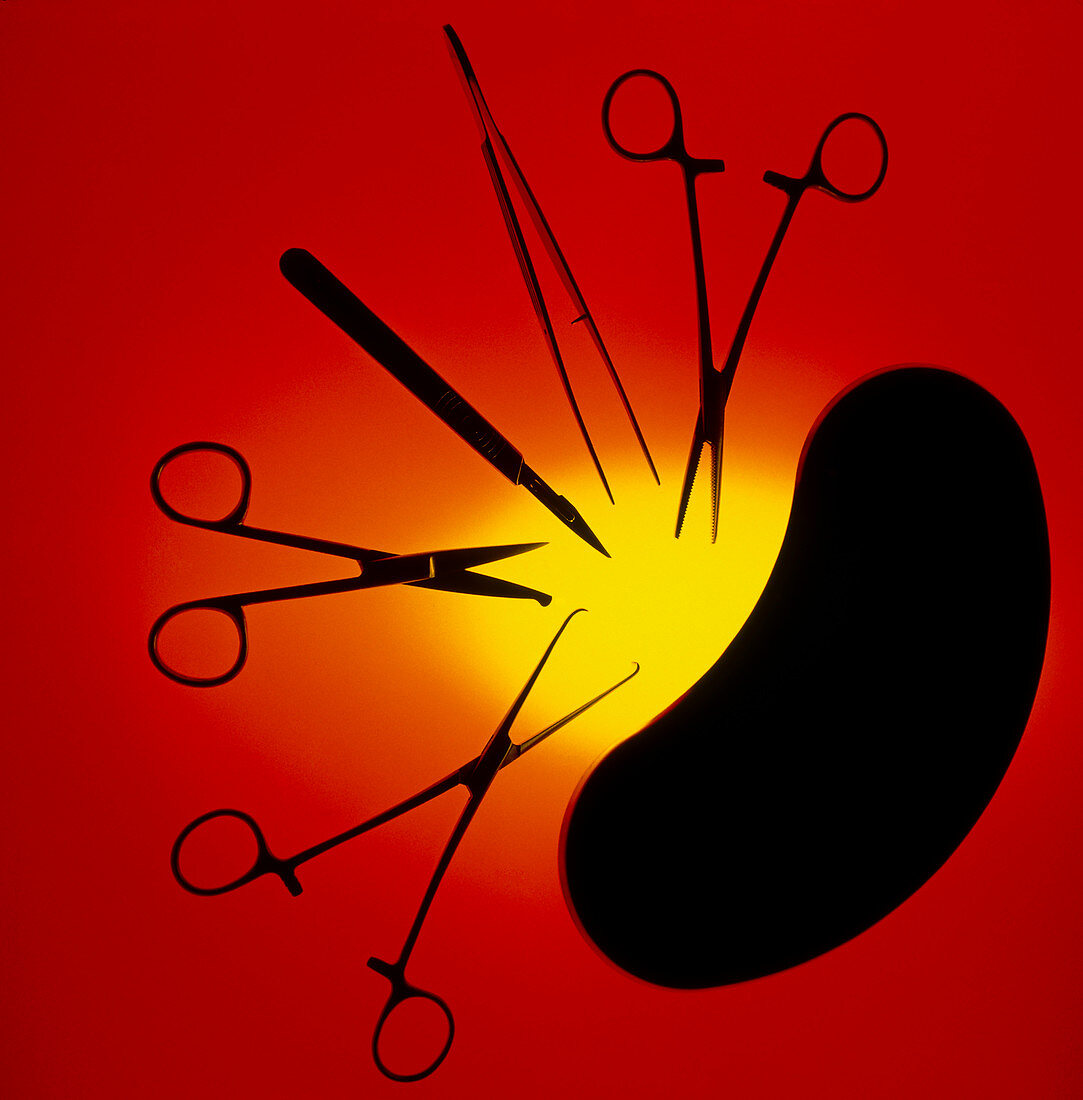 Silhouette of assorted surgical equipment