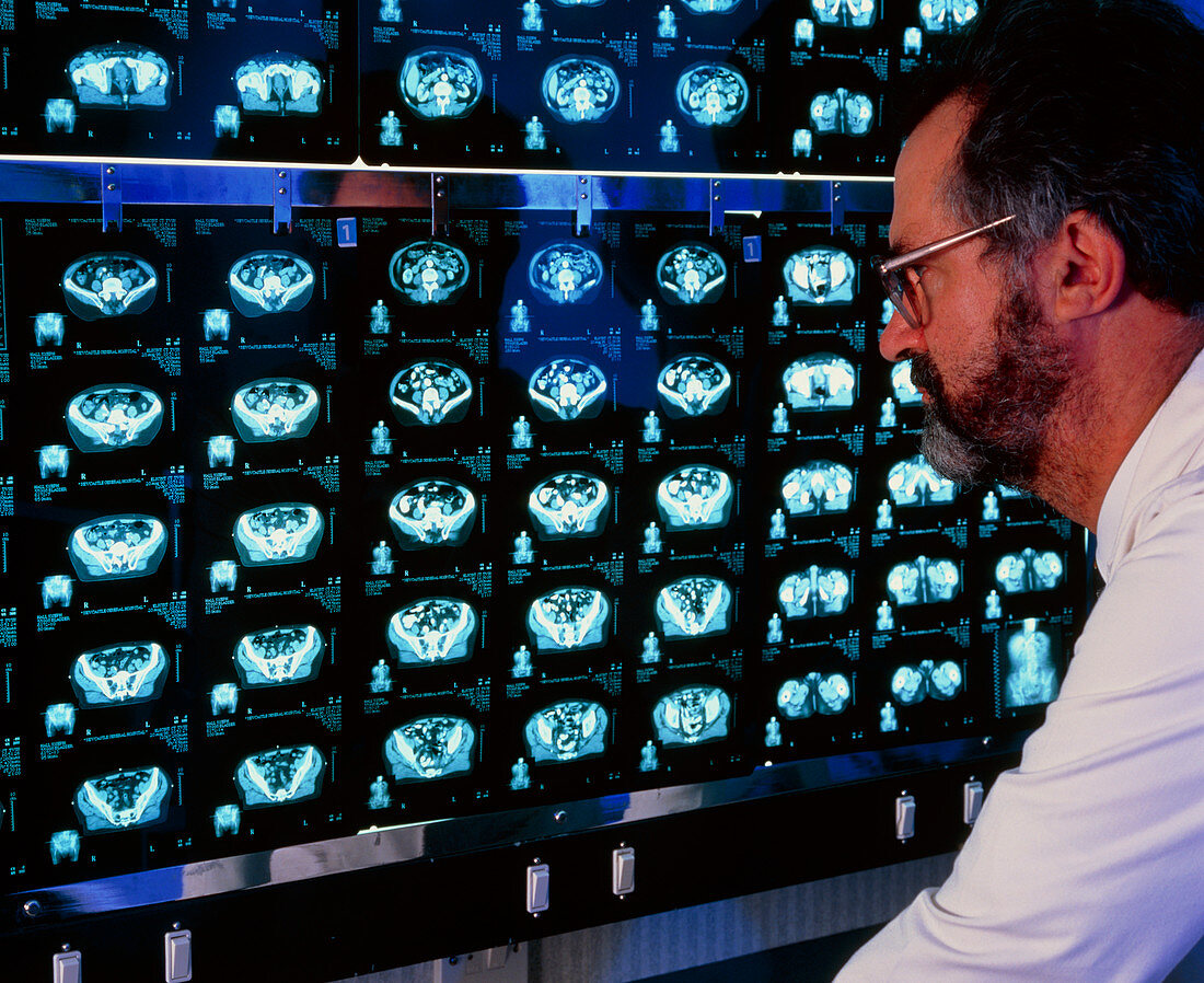 Radiographer examining a series of CT scans