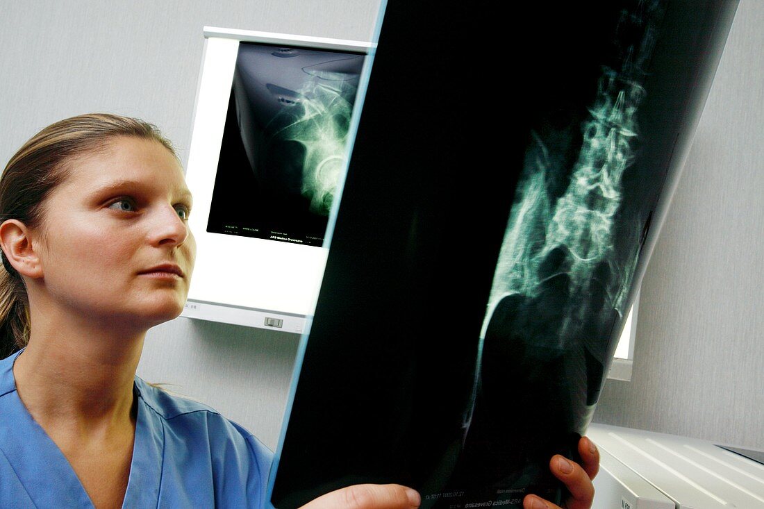 Radiologist studying an X-ray