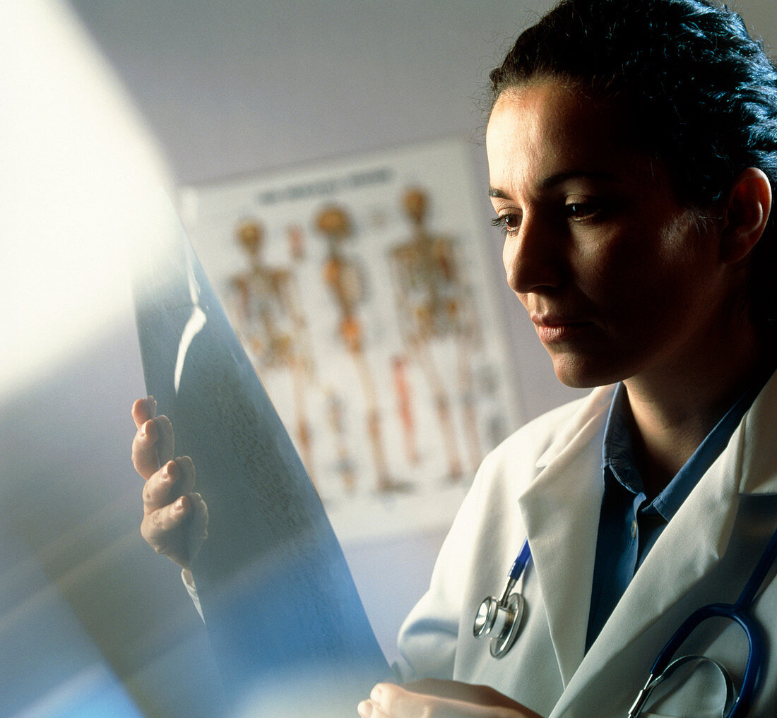 Female doctor studying an X-ray image