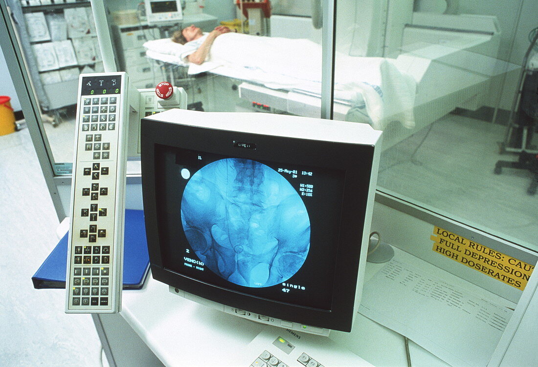 Bladder X-ray examination