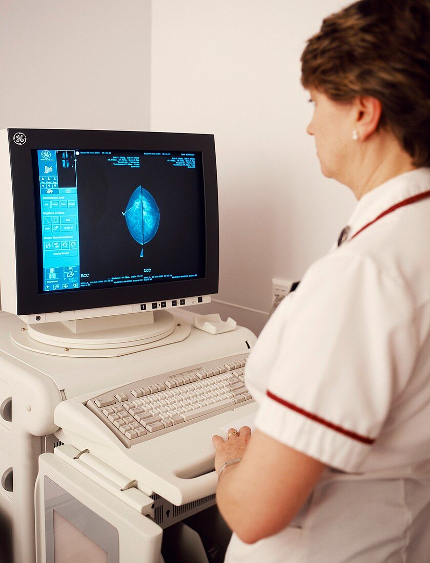 Breast X-rays