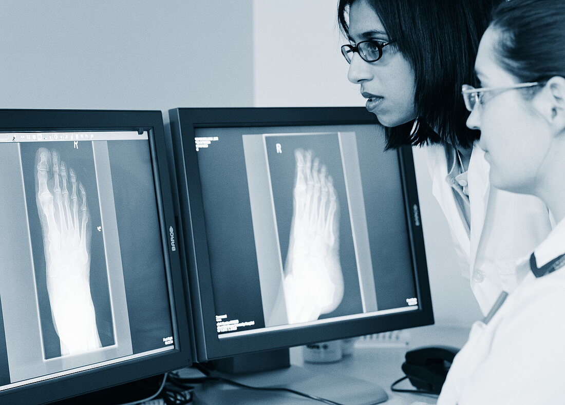 Foot X-rays