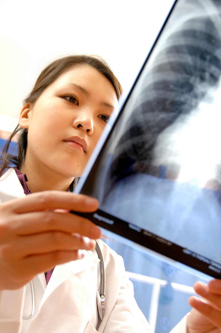 Doctor studying a chest X-ray