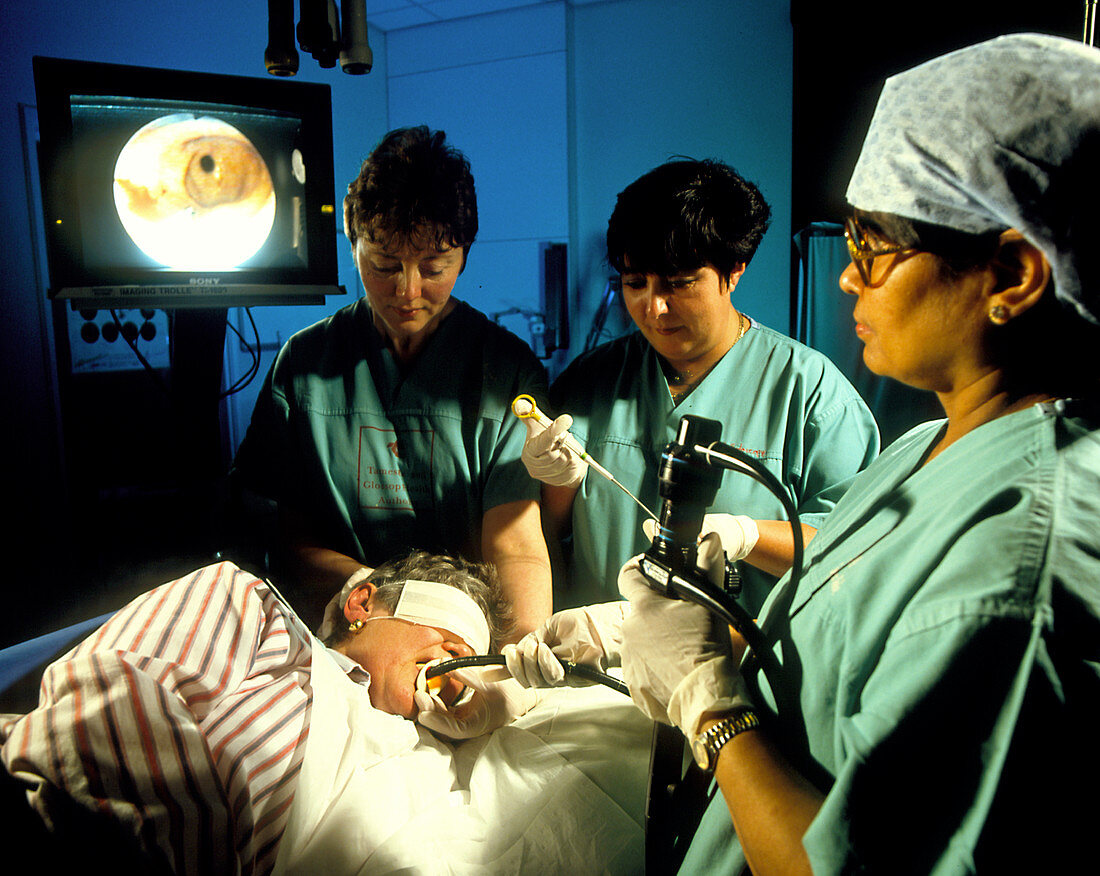 Endoscope examination & biopsy of the stomach