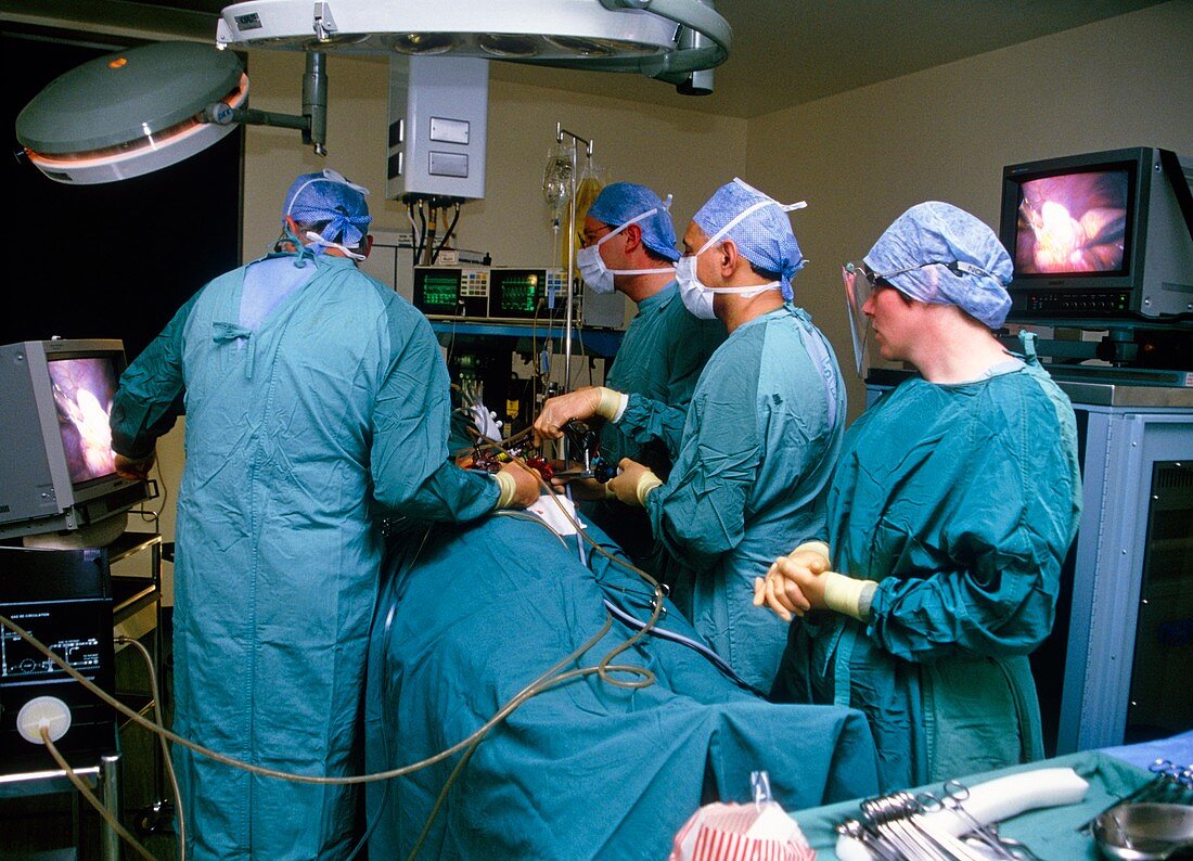 Surgeons using laparoscope in gall bladder surgery