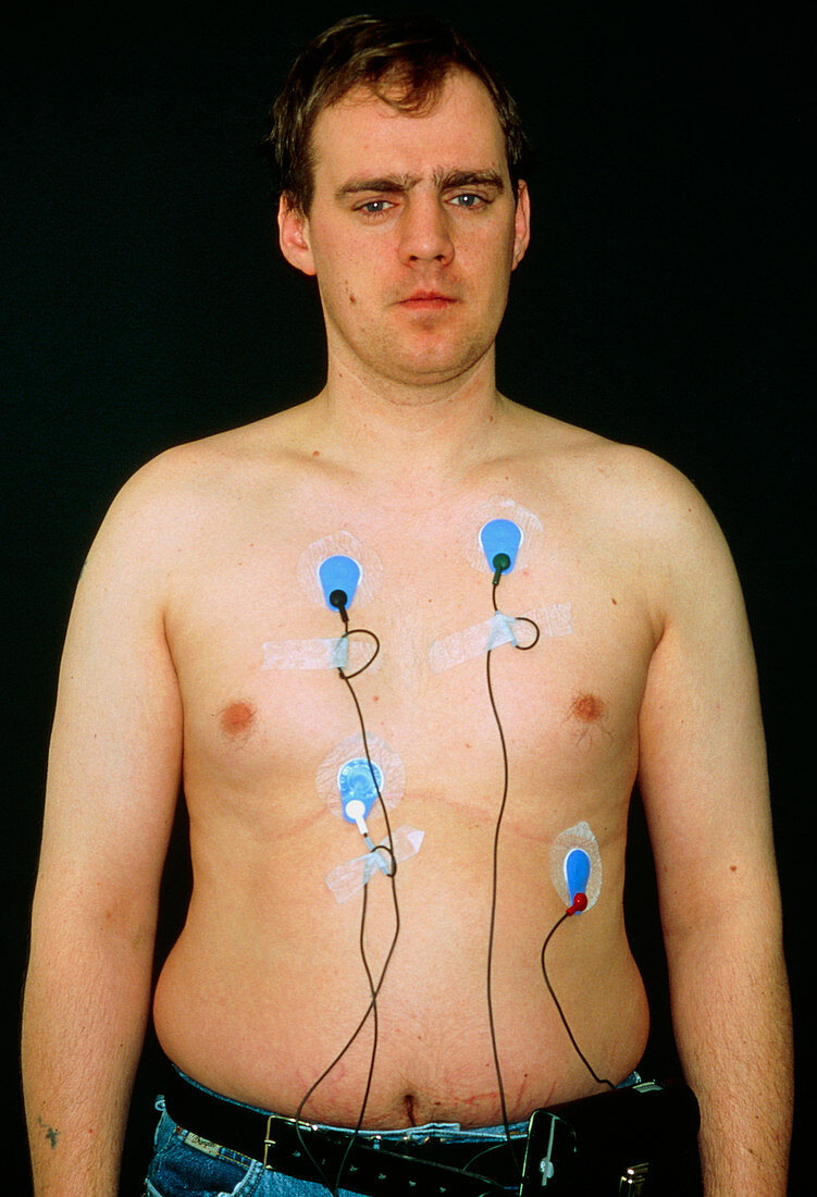Patient wearing a Holter monitor: portable ECG