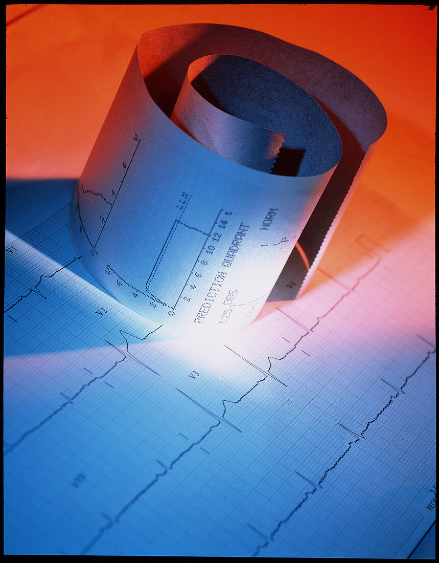Healthy electrocardiograph and vitalograph traces