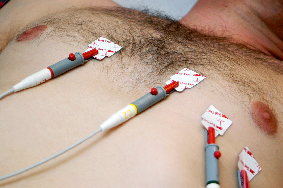 Electrocardiography electrodes
