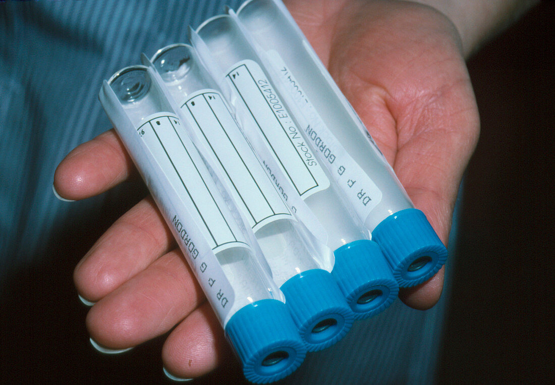 Gastric ulcer breath test: breath sample tubes