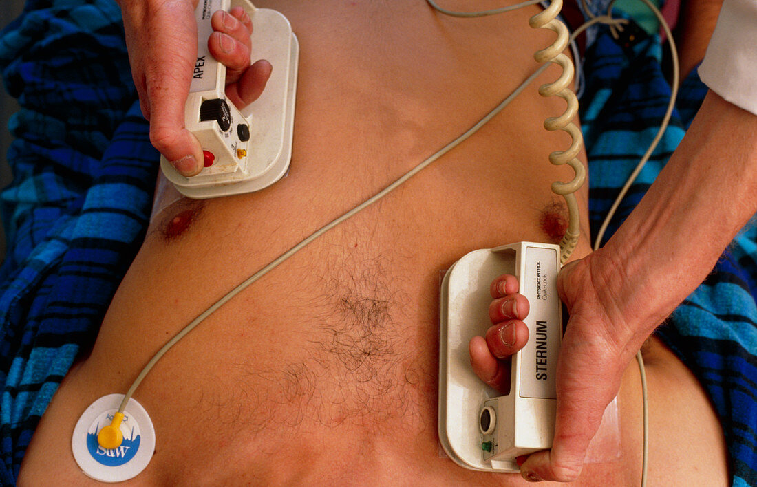 Use of defibrillator on heart attack victim