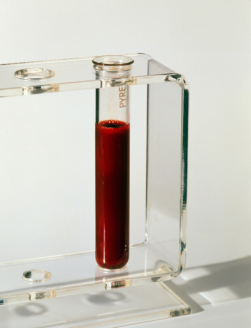 Sample of blood in a test tube ready for analysis