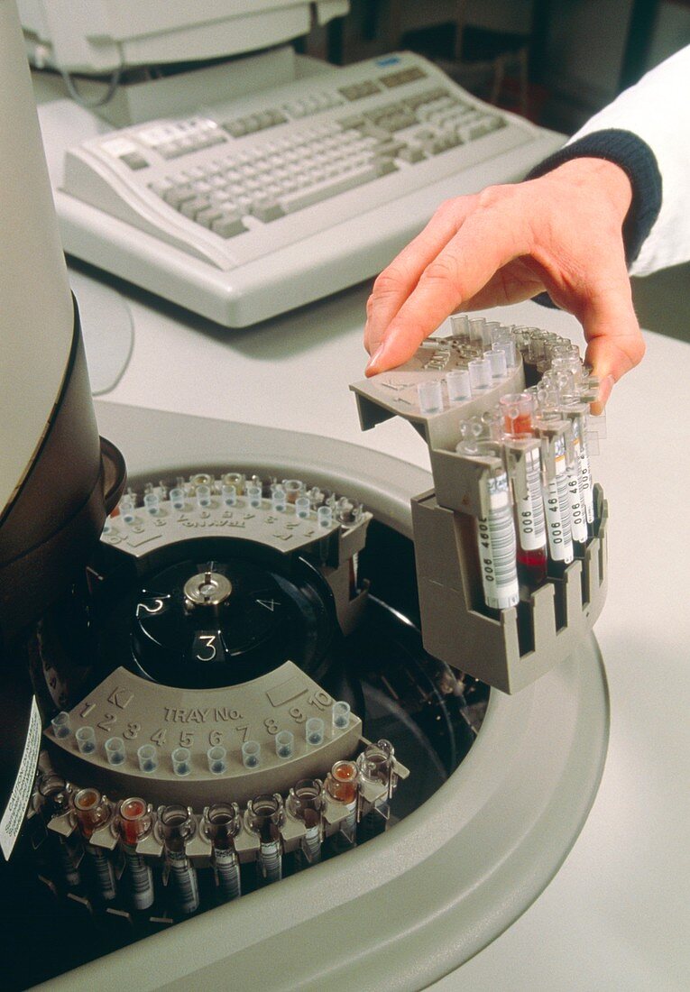 Hand loading a Vitros Analyser for blood analysis
