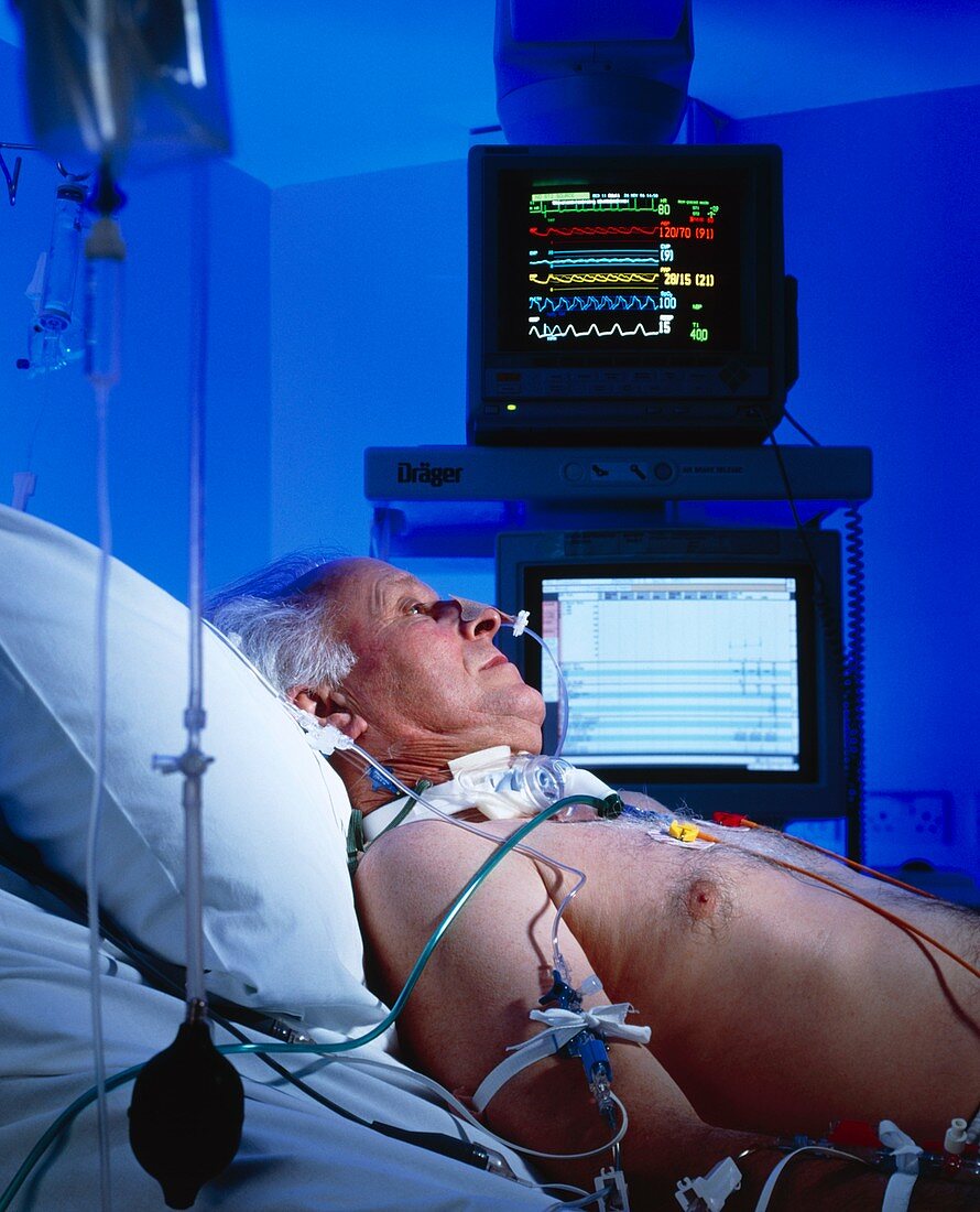 Intensive care monitoring of an elderly man