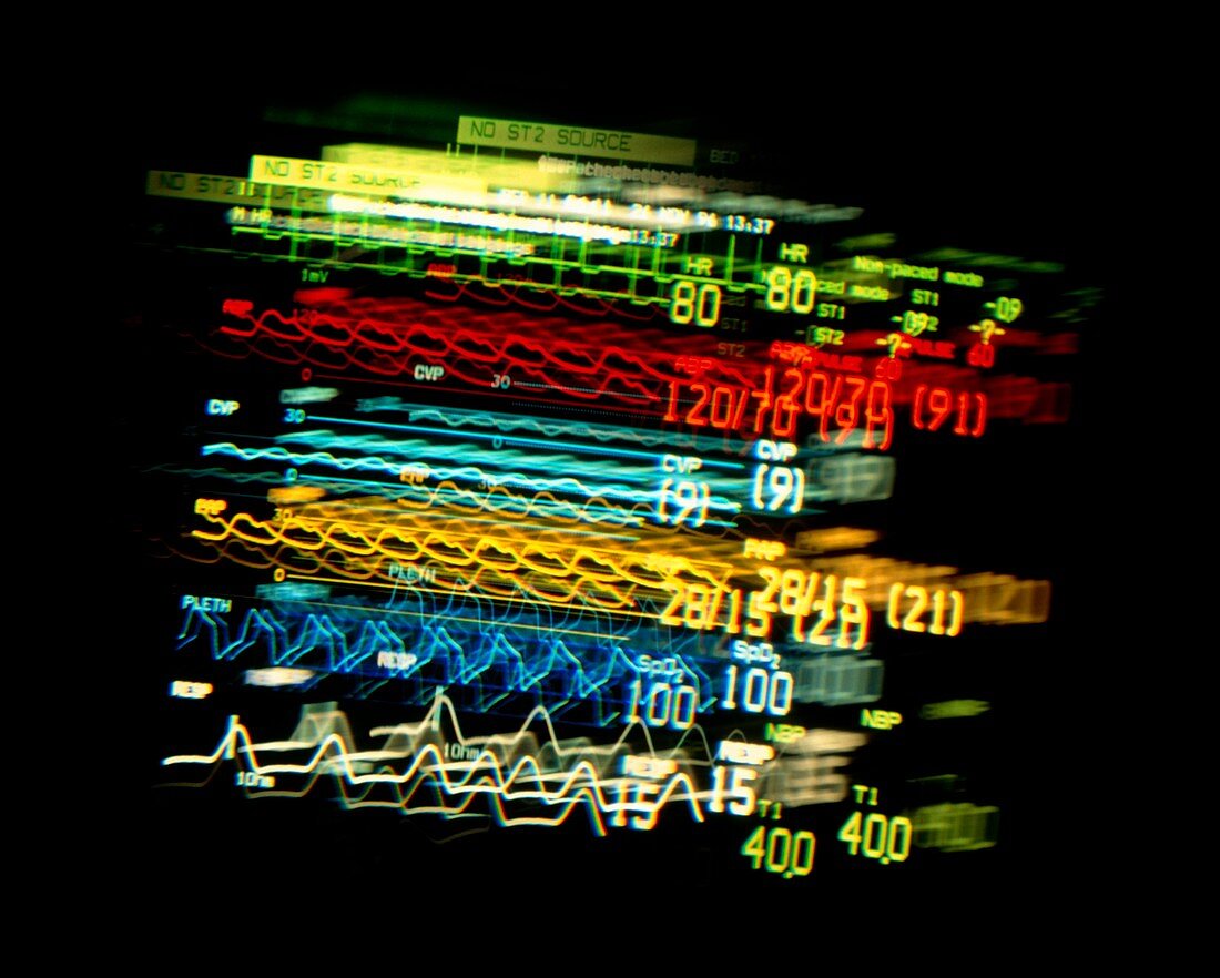 Blurred monitor of patient's abnormal vital signs