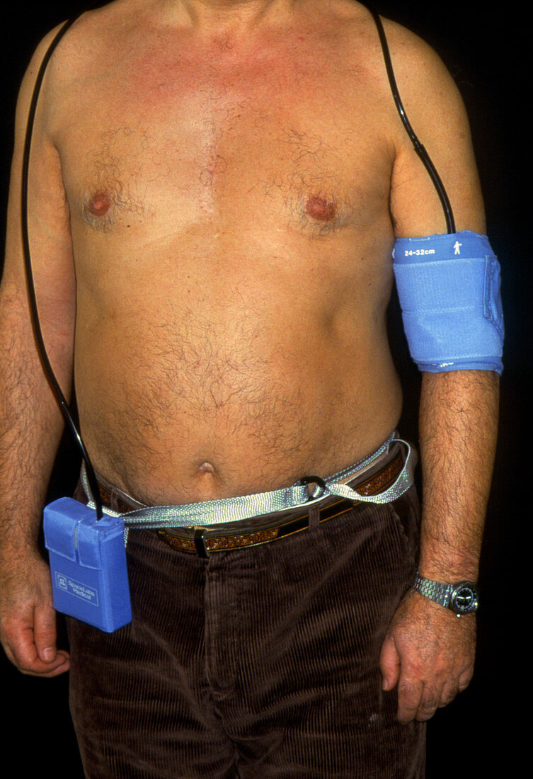 Man wearing ambulatory blood pressure monitor