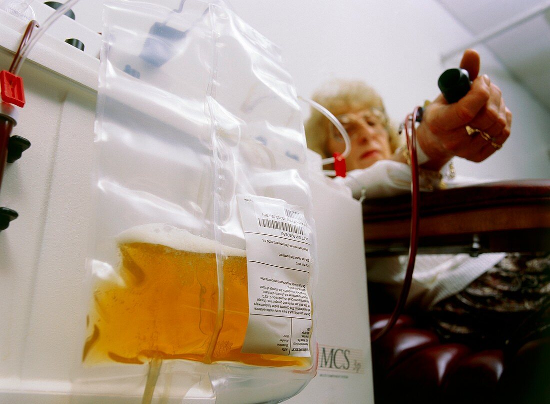 Blood bag containing platelets,and woman donor