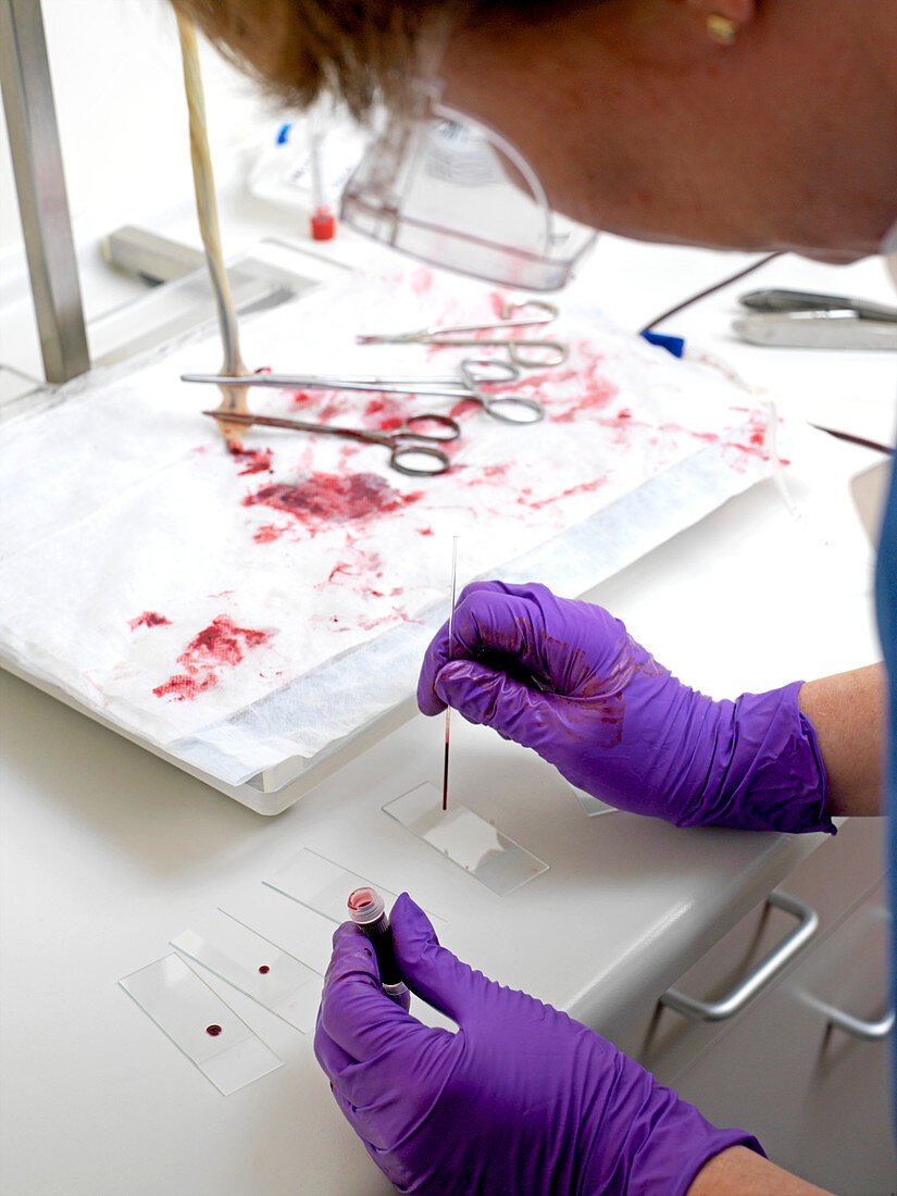 Testing umbilical cord blood